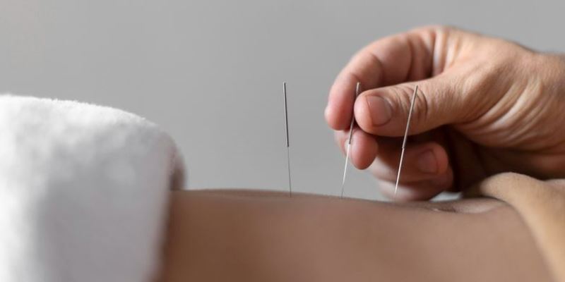 Bisakah Akupunktur Membantu Meringankan Rasa Sakit Kronis Anda?