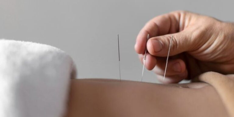 Bisakah Akupunktur Membantu Meringankan Rasa Sakit Kronis Anda?